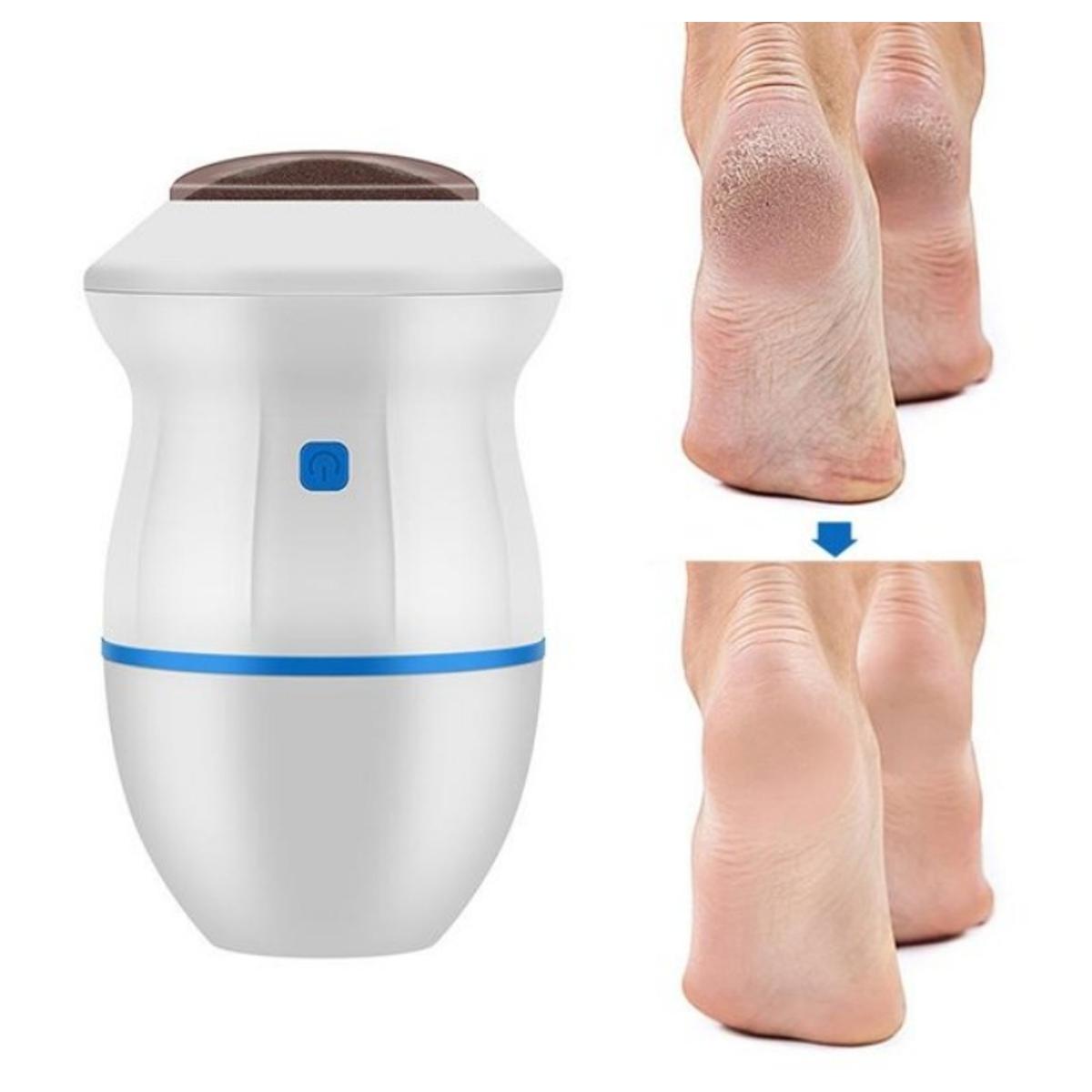 ЕЛЕКТРИЧНА ТУРПИЈА