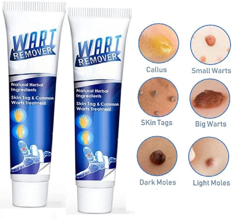 Крем за брадавици и кожни израстоци 1+1 ГРАТИС