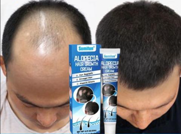 КРЕМА ПРОТИВ ОПАЃАЊЕ НА КОСА 1+1 ГРАТИС